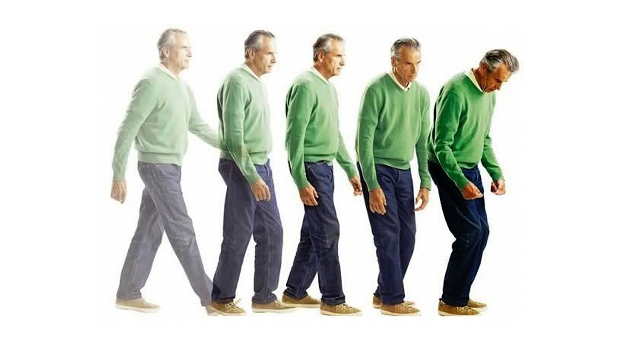 Bệnh Parkinson – Căn bệnh âm thầm nhưng nguy hiểm ảnh hưởng đến não bộ và vận động
