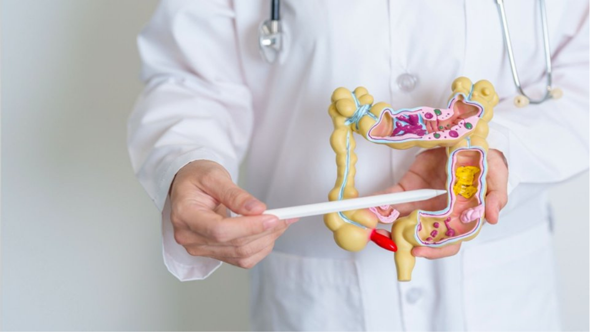 Phân Biệt Hội Chứng Ruột Kích Thích Và Viêm Đại Tràng: Đừng Nhầm Lẫn