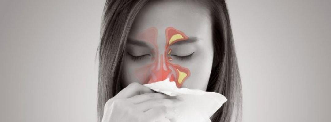 Viêm xoang: Bệnh dai dẳng gây mệt mỏi và cách điều trị toàn diện