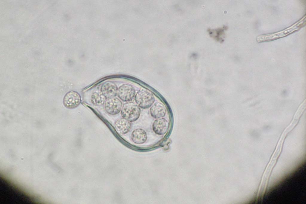 nấm phytophthora palmivora