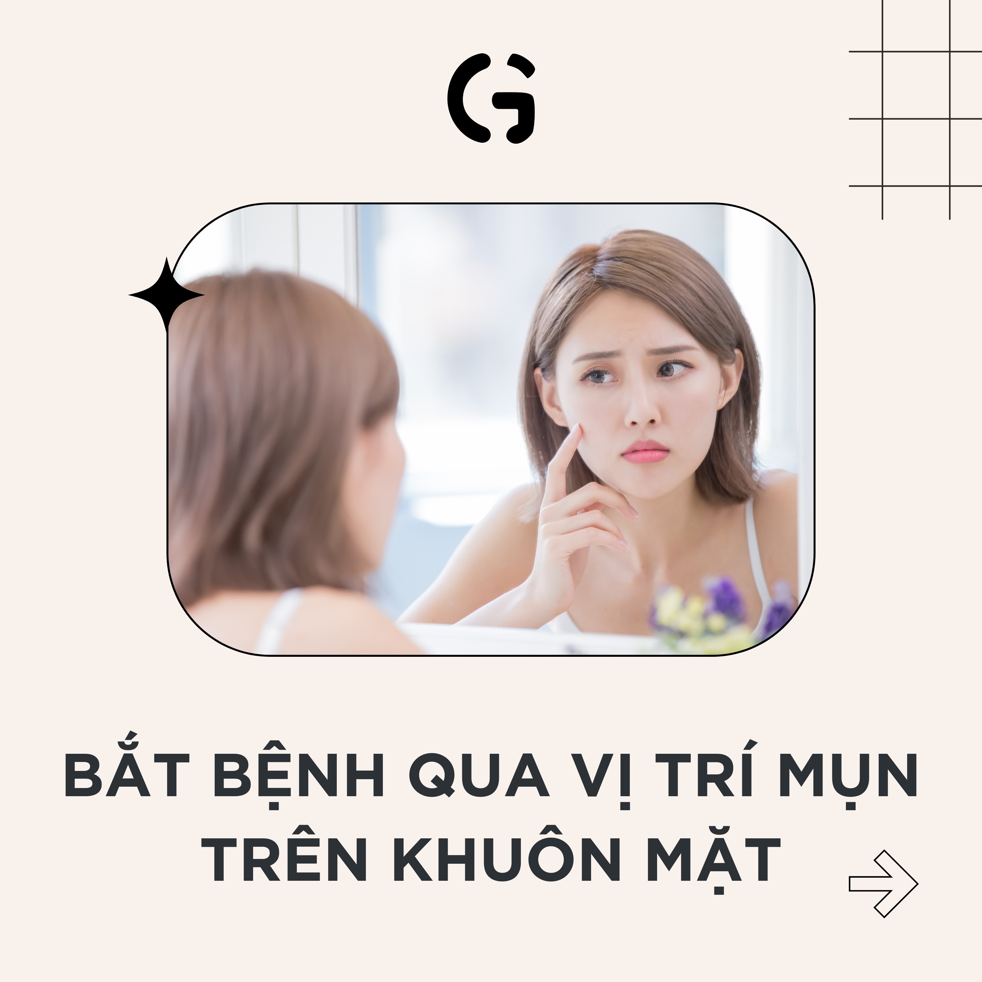 Bắt bệnh qua vị trí mụn trên khuôn mặt