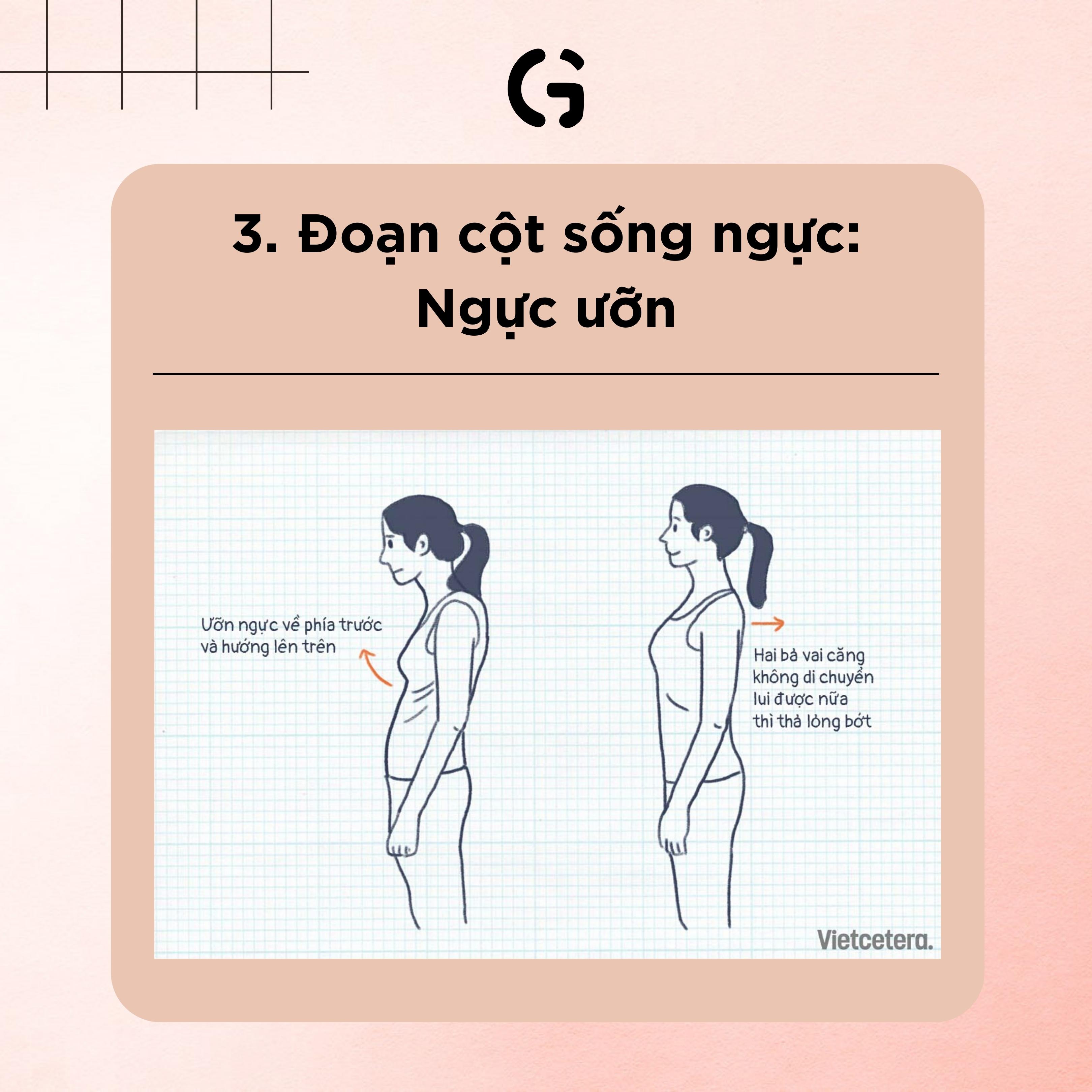 Chuyện cột sống của chúng mình