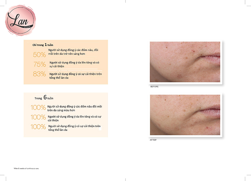 Serum Giảm Nám 7 Ngày RAPID AGE SPOT CORRECTING SERUM