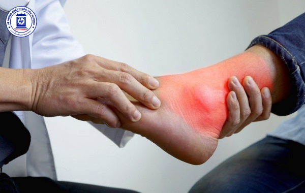 Tìm hiểu tổng quan về bệnh gout: Nguyên nhân, triệu chứng và cách giảm đau hiệu quả