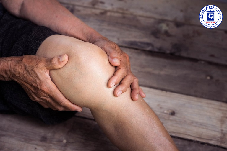 Xử Lý Sưng Đầu Gối: Nguyên Nhân và Cách Điều Trị Hiệu Quả