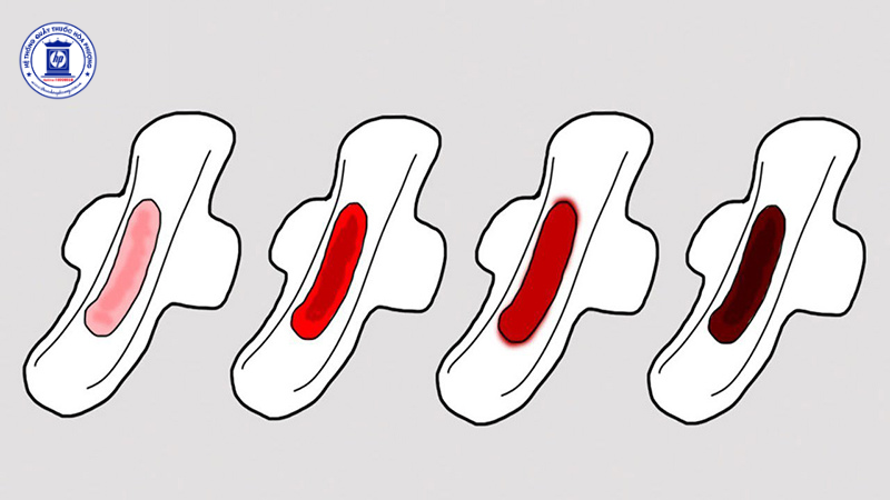 Kinh Nguyệt Ra Nhiều: Nguyên Nhân Tiềm Ẩn và Giải Pháp Chăm Sóc Hiệu Quả Cho Sức Khỏe Phụ Nữ