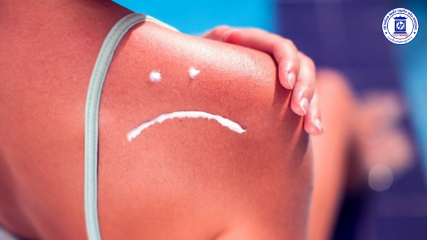 Da bị cháy nắng: Nguyên nhân, hậu quả và biện pháp khắc phục