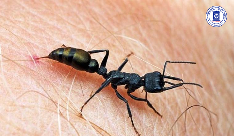 Cách Xử Lý An Toàn Khi Bé Bị Kiến Lửa Cắn