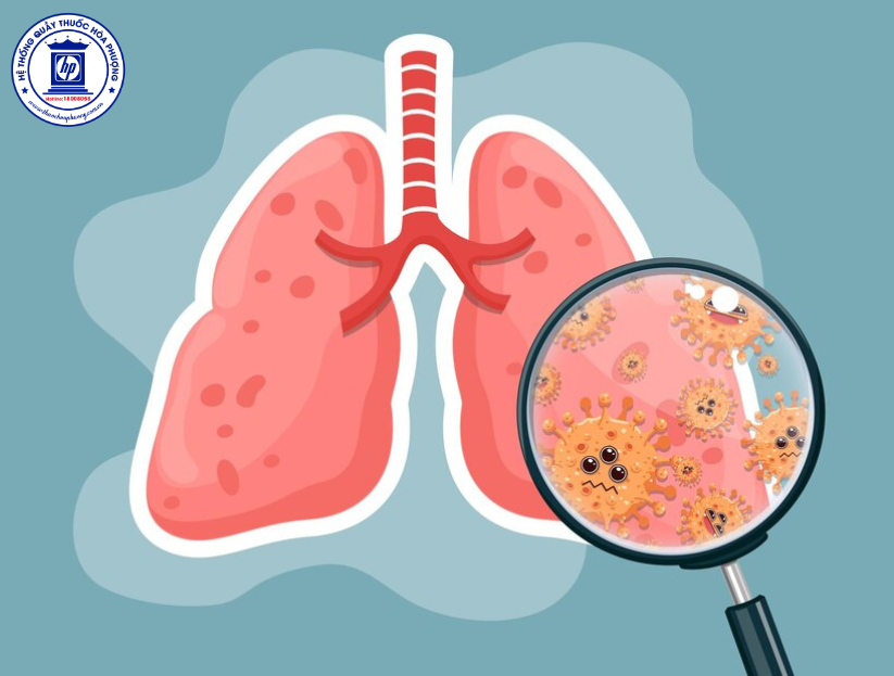 9 lầm tưởng và sự thật về bệnh viêm phổi