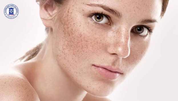 Hé Lộ 8 Nguyên Nhân Chính Gây Nám Da Thường Gặp