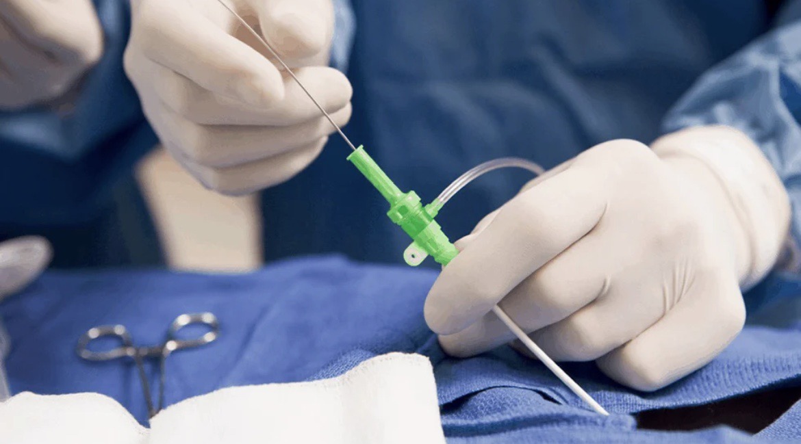 Sinh thiết tuyến tiền liệt là gì? Có đau không?