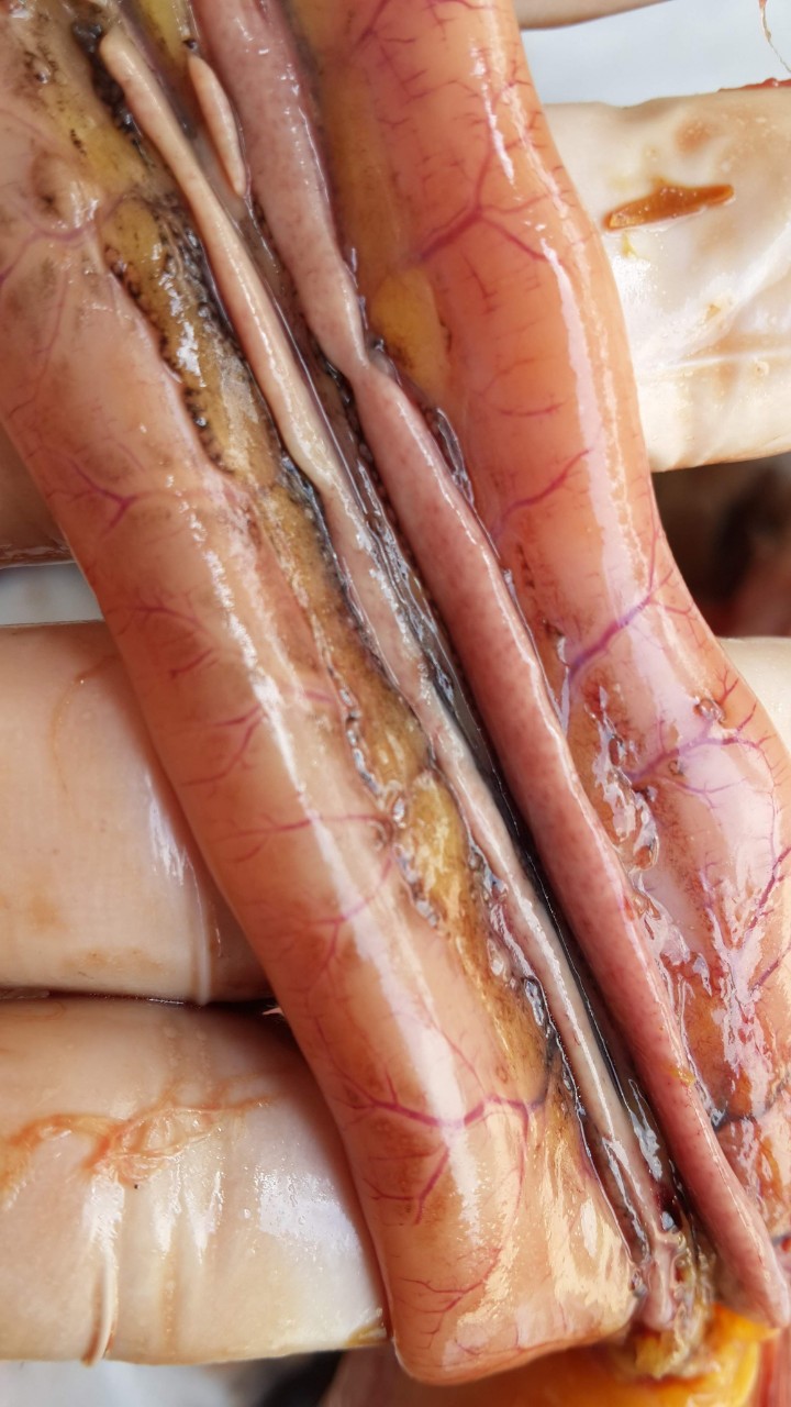 Bệnh viêm ruột hoại tử