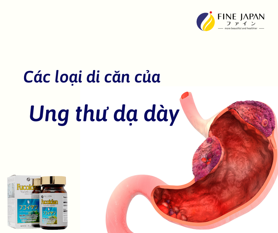 Ung thư dạ dày di căn Ung thư dạ dày di căn