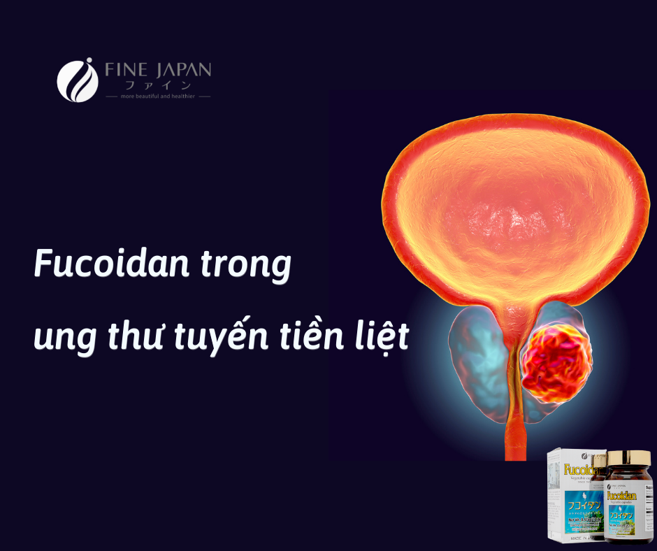 Tác dụng không ngờ của Fucoidan trong ngăn ngừa và hỗ trợ điều trị ung thư tuyến tiền liệt Tác dụng không ngờ của Fucoidan trong ngăn ngừa và hỗ trợ điều trị ung thư tuyến tiền liệt