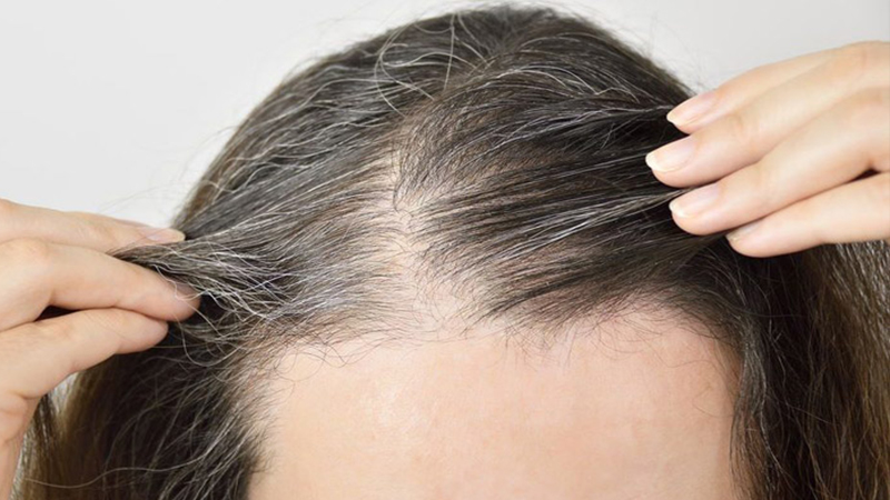 Dầu gội đen tóc là giải pháp nhuộm tóc an toàn tại nhà