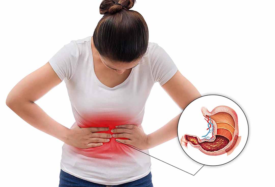 Nguyên Nhân Phổ Biến Gây Đau Dạ Dày Và Cách Khắc Phục