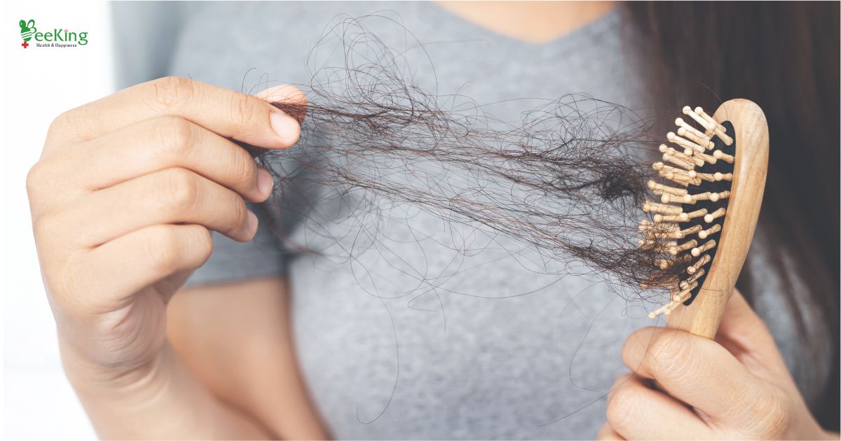 Rụng tóc sau sinh: Có phải điều bình thường?