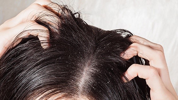 Tóc bết dầu phải làm sao để khắc phục?