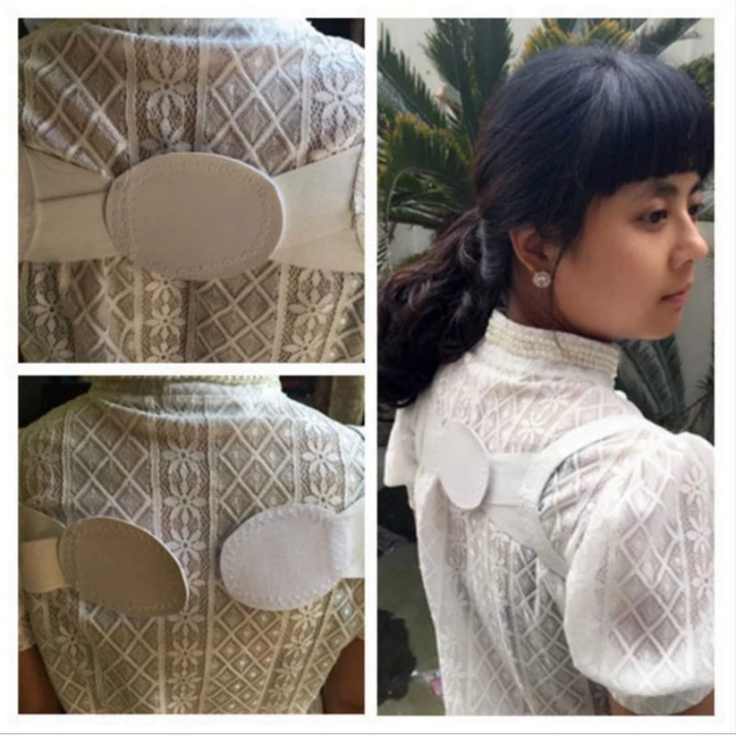 ĐAI ĐỊNH HÌNH VAI CỔ GÁY