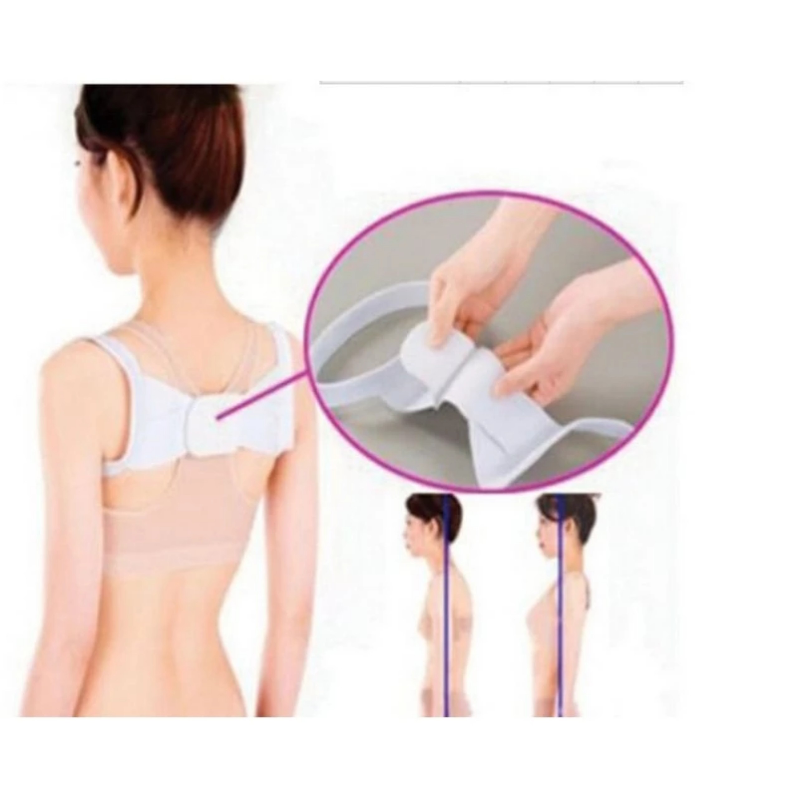 ĐAI ĐỊNH HÌNH VAI CỔ GÁY