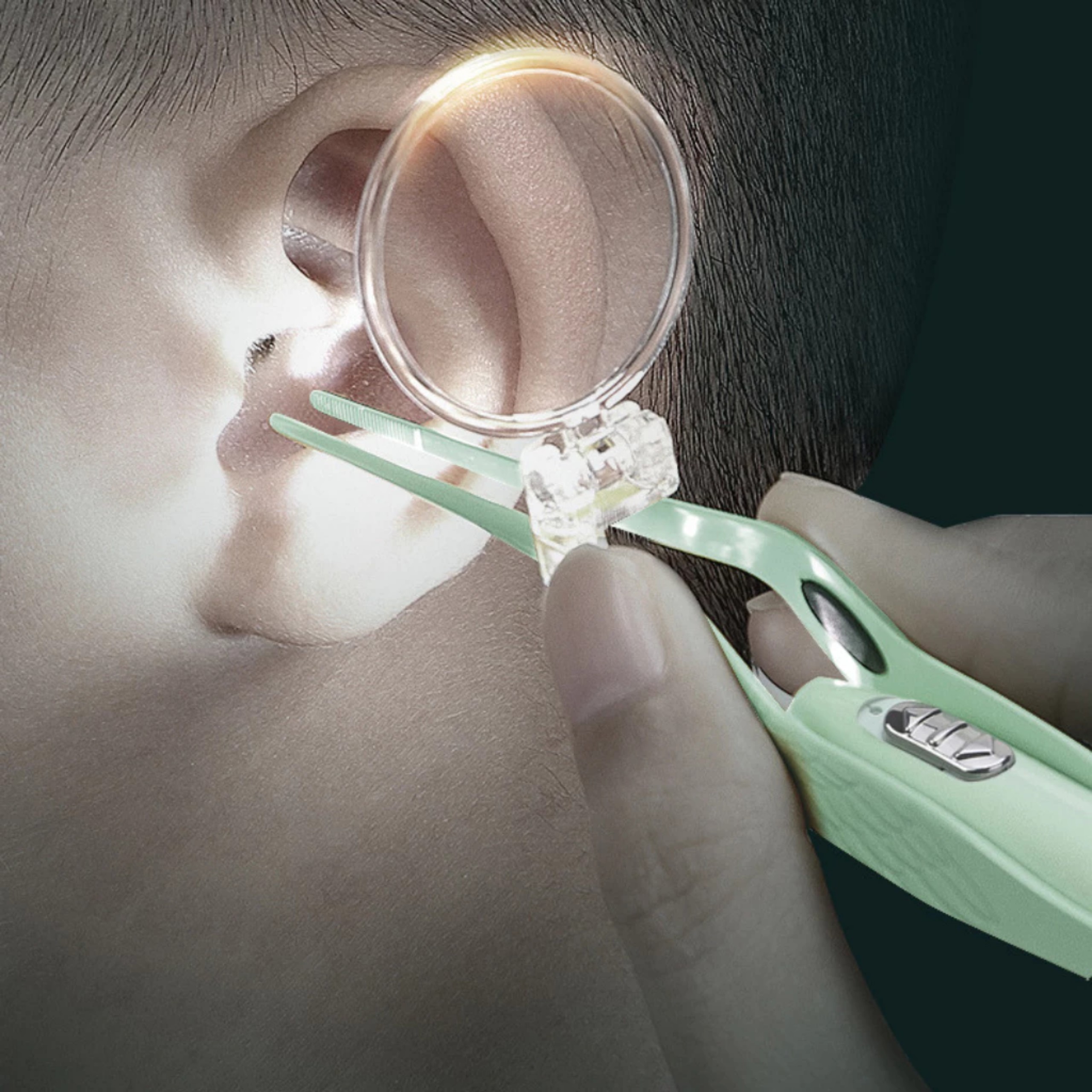 DỤNG CỤ RÁY TAI ĐÈN LED HỘP NHỰA