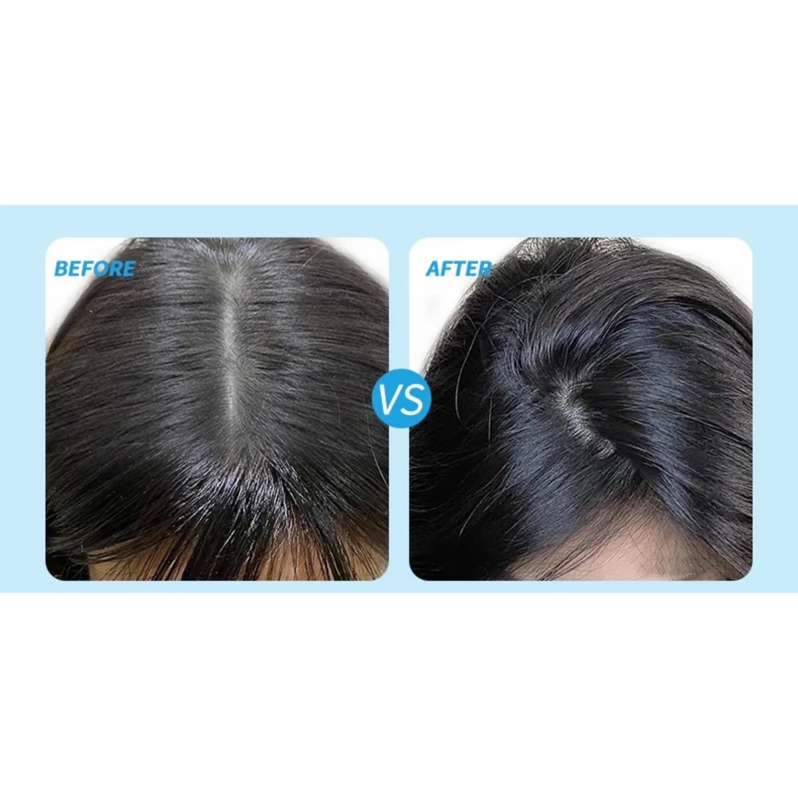 DẦU GỘI KHÔ DẠNG XỊT NỘI ĐỊA TRUNG