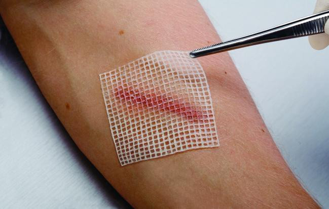 Cuticell® Classic-Băng gạc tẩm parafin