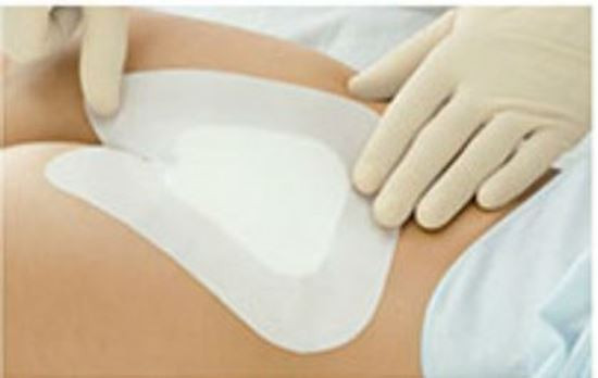 Cutimed siltec sacrum