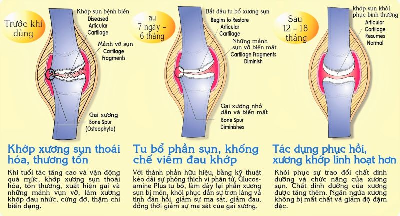 Đánh giá tác dụng của Glucosamin sau thời gian sử dụng 