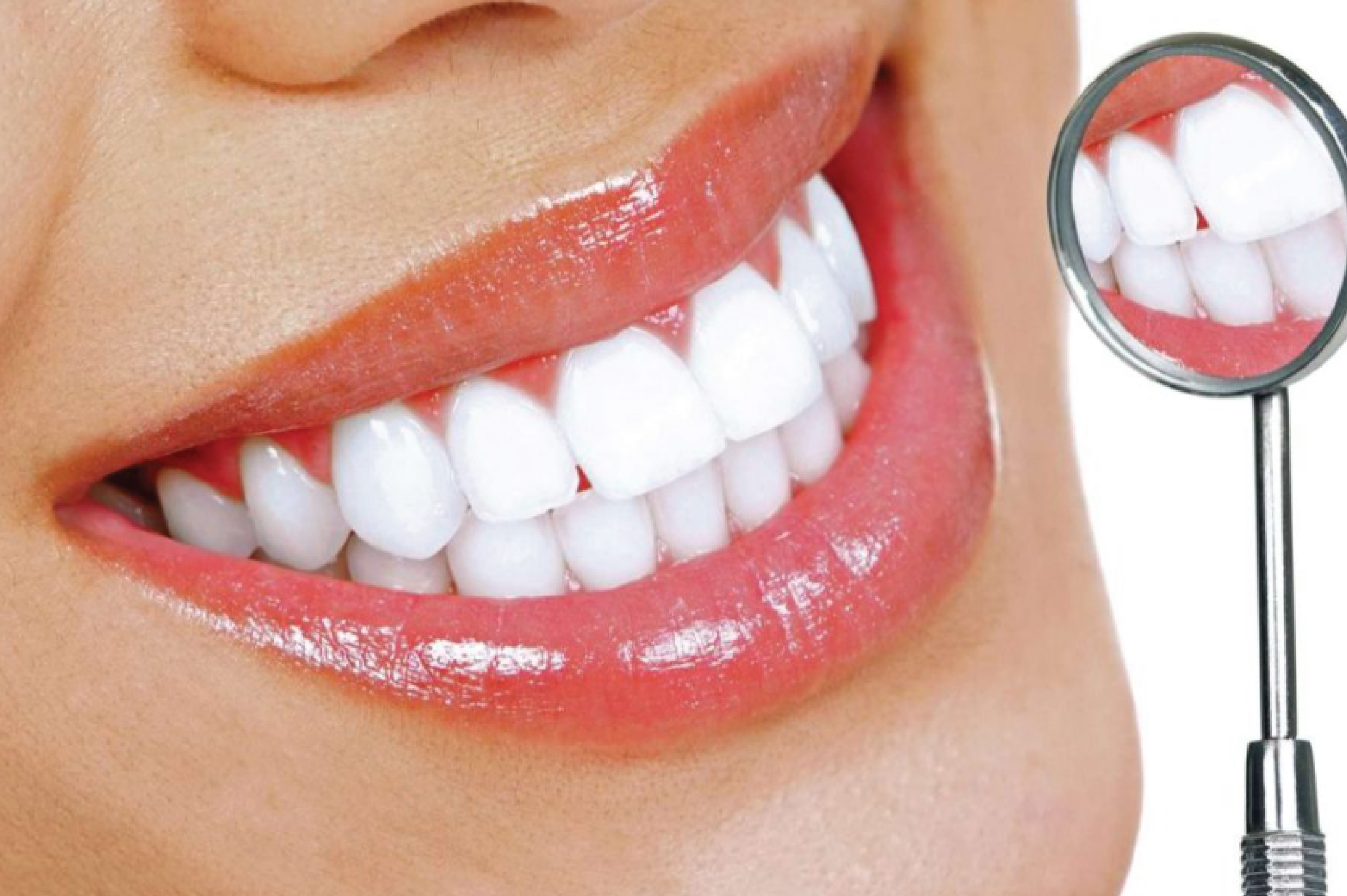 PHÒNG NGỪA BỆNH SÂU RĂNG HIỆU QUẢ NHỜ NƯỚC ĐIỆN GIẢI ION KIỀM