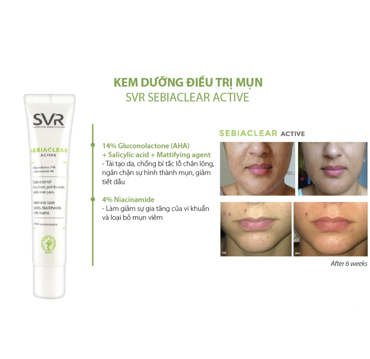 Kem dưỡng trị mụn SVR Sebiaclear Active