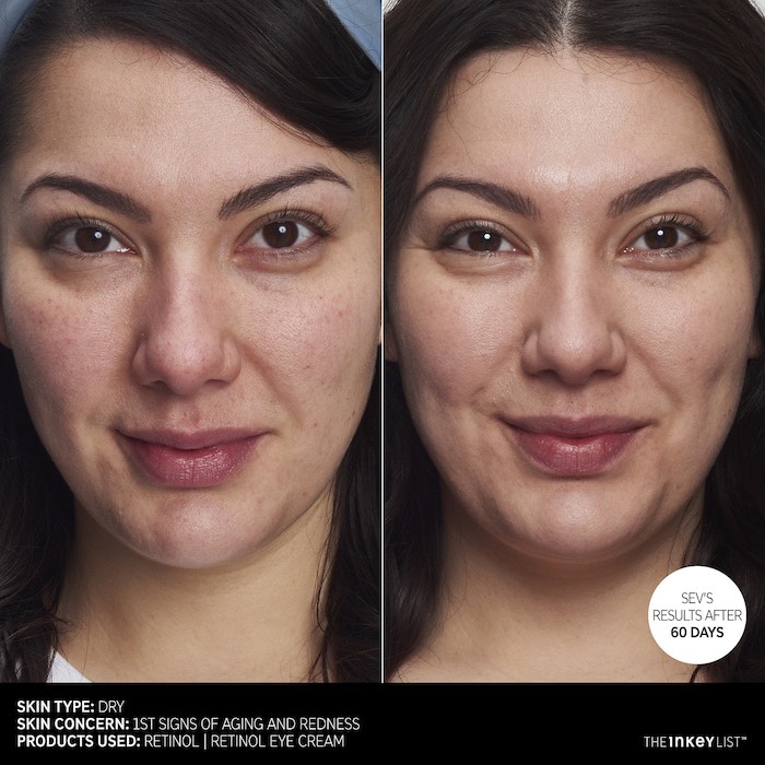 Retinol Anti-Aging Serum