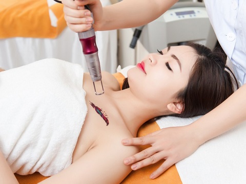 Laser và các ứng dụng trong y học thẩm mỹ