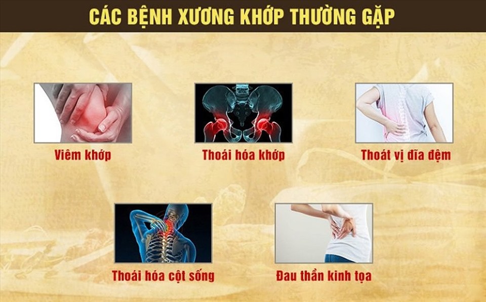 Các bệnh xương khớp 