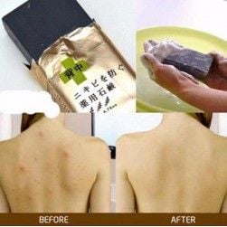 Xà Phòng Giảm Mụn Lưng Pelican For Back 135g