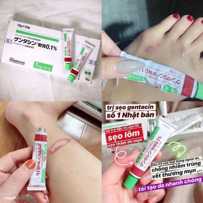 Kem Trị Sẹo GENTACIN Tuýp 10g