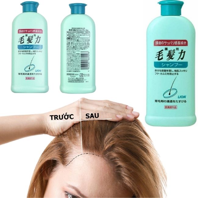 Dầu Gội Lion Ngăn Ngừa Rụng Tóc Giúp Mọc Tóc 200Ml