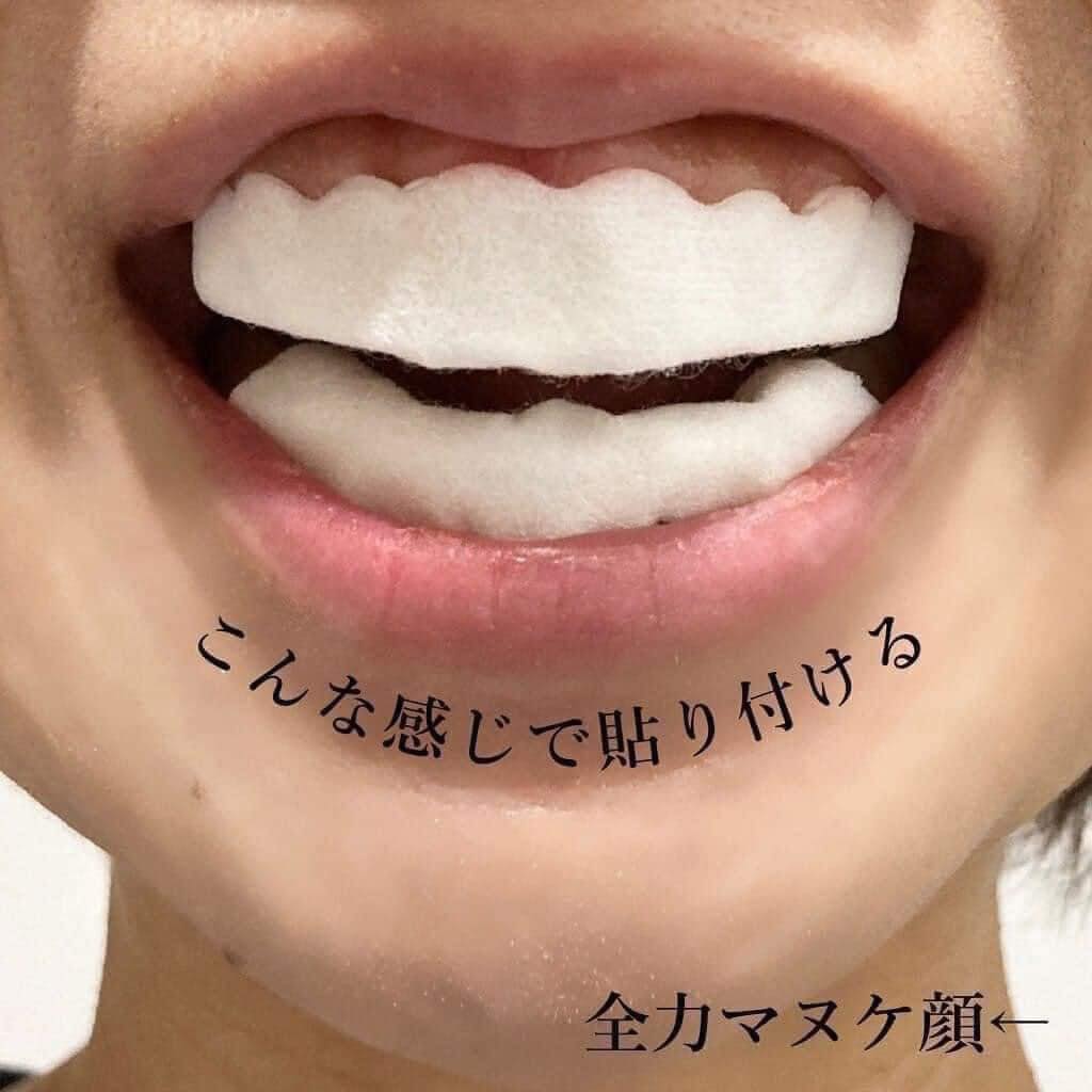 Miếng dán làm trắng răng SMILE COSMETIQUE dòng Premium