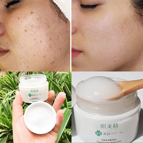 Kem Dưỡng Trắng Da Trị Mụn Kracie 50g