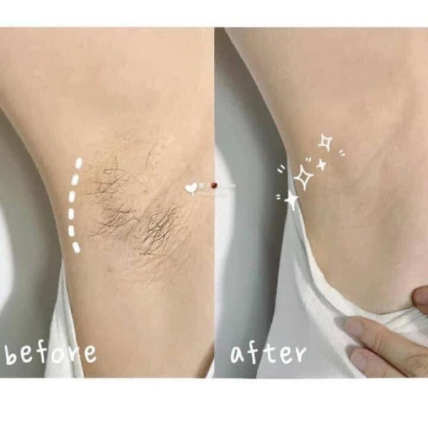 Kem Tẩy Lông Veet Pure Chiết Xuất Bơ Hạt Mỡ - 150Gr