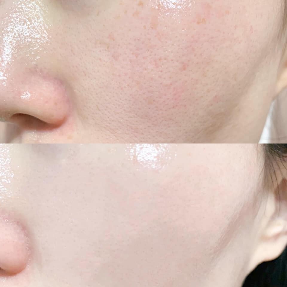 Serum Chống Lão Hóa Pure Retinol High Class Moist Essence 60Ml