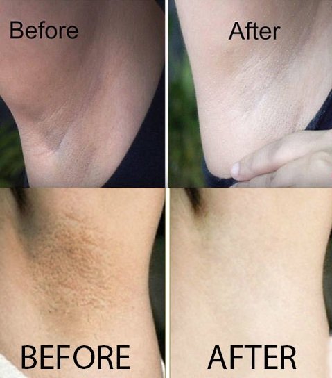 Xà Phòng Trị Thâm Nách Pelican For Back 80G - Nhật Bản