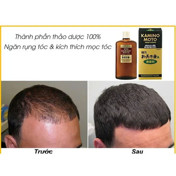 Tinh Chất Kích Thích Mọc Tóc KAMINOMOTO 200ML