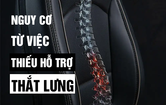 Đau lưng khi lái xe: Nguy cơ từ việc thiếu hỗ trợ thắt lưng