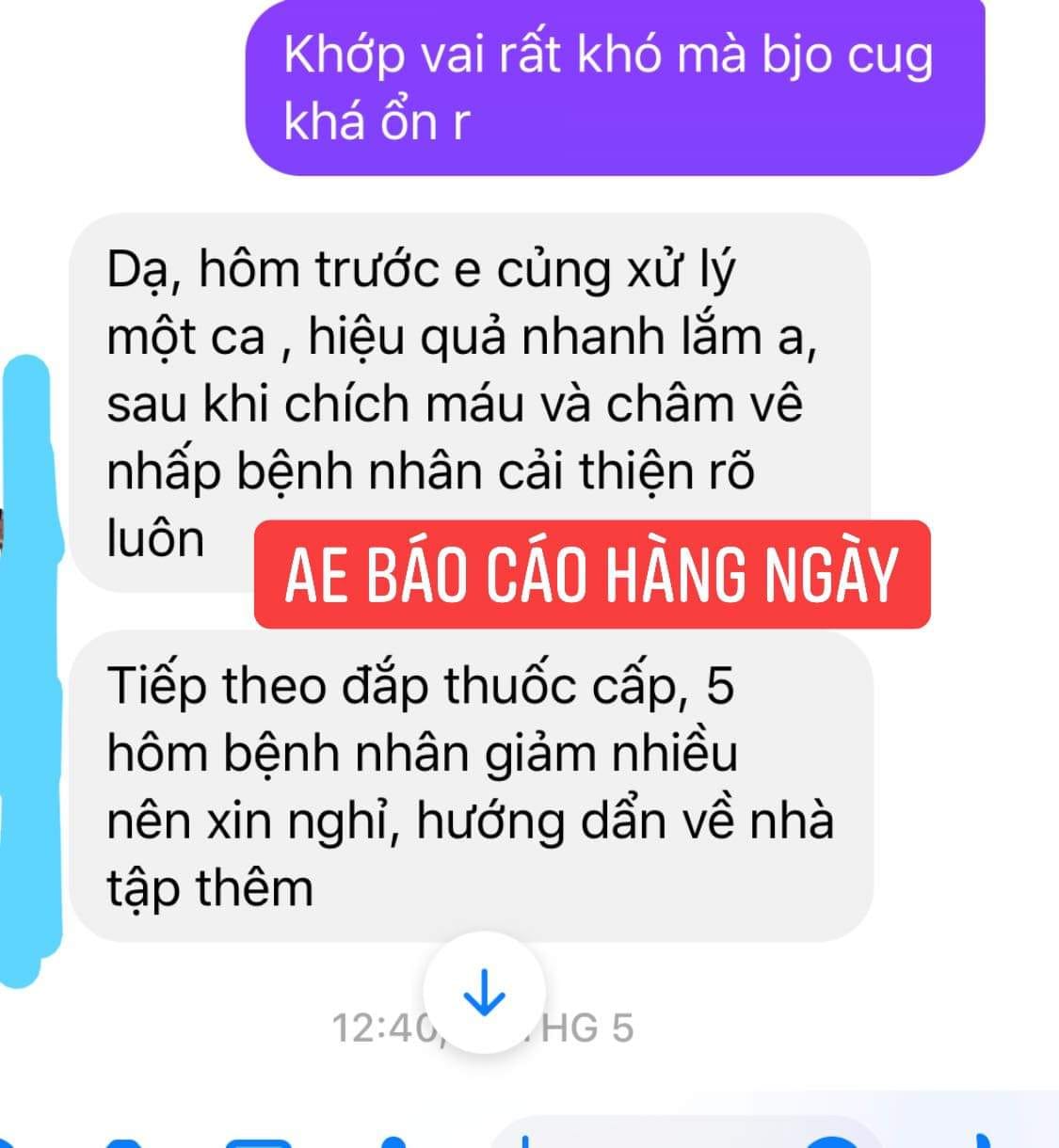 CAO ĐẮP XƯƠNG KHỚP CẤP TÍNH ( VIÊM, SƯNG, TRÀN DỊCH KHỚP)
