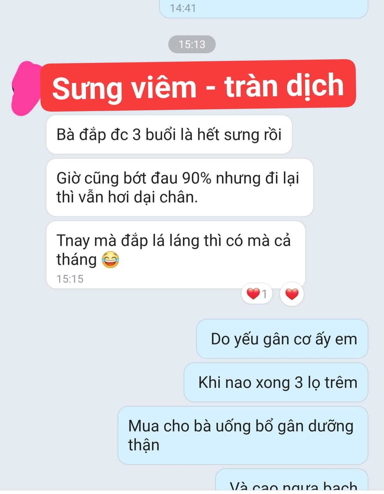 CAO ĐẮP XƯƠNG KHỚP CẤP TÍNH ( VIÊM, SƯNG, TRÀN DỊCH KHỚP)