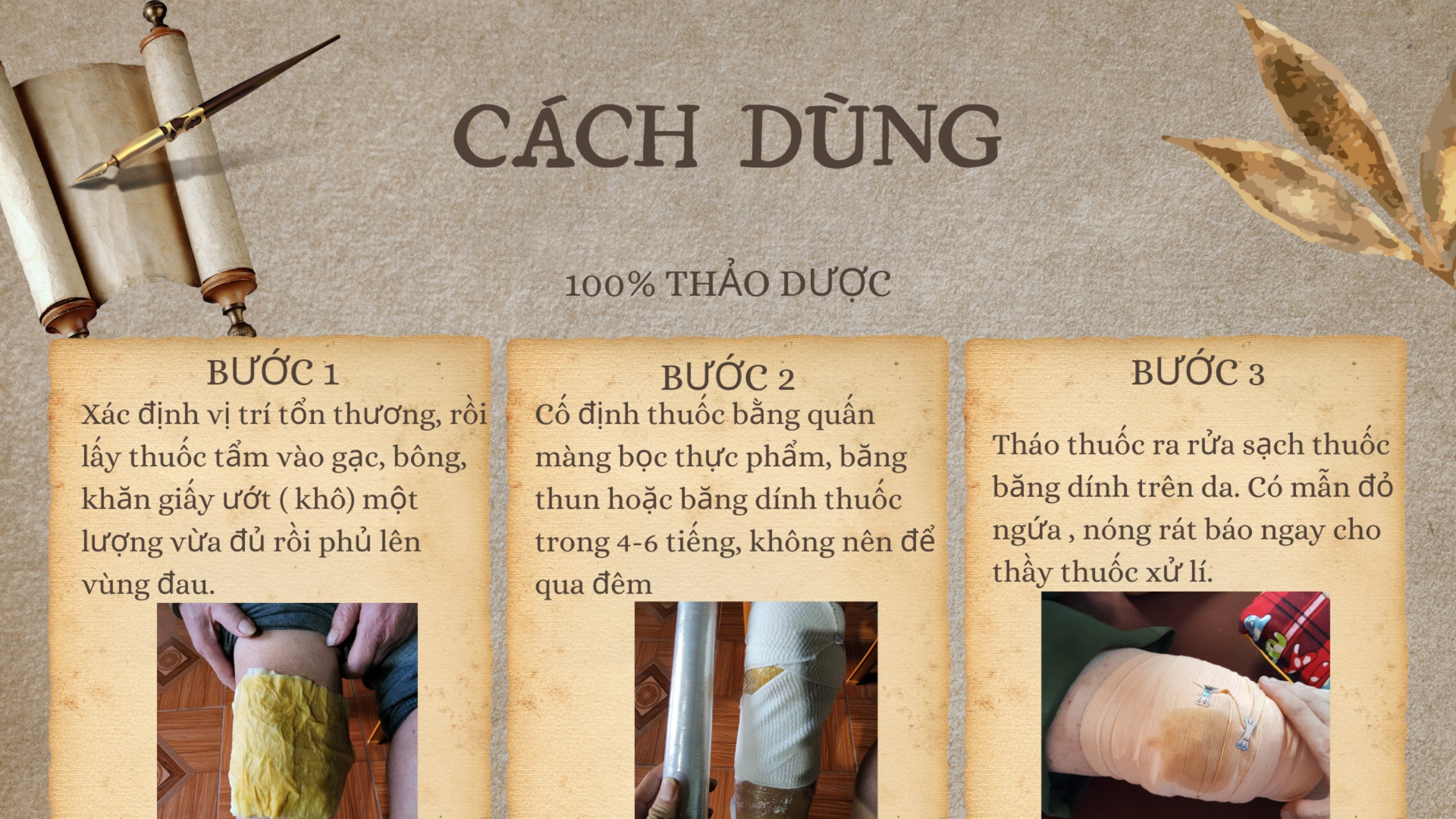 CAO ĐẮP XƯƠNG KHỚP CẤP TÍNH ( VIÊM, SƯNG, TRÀN DỊCH KHỚP)