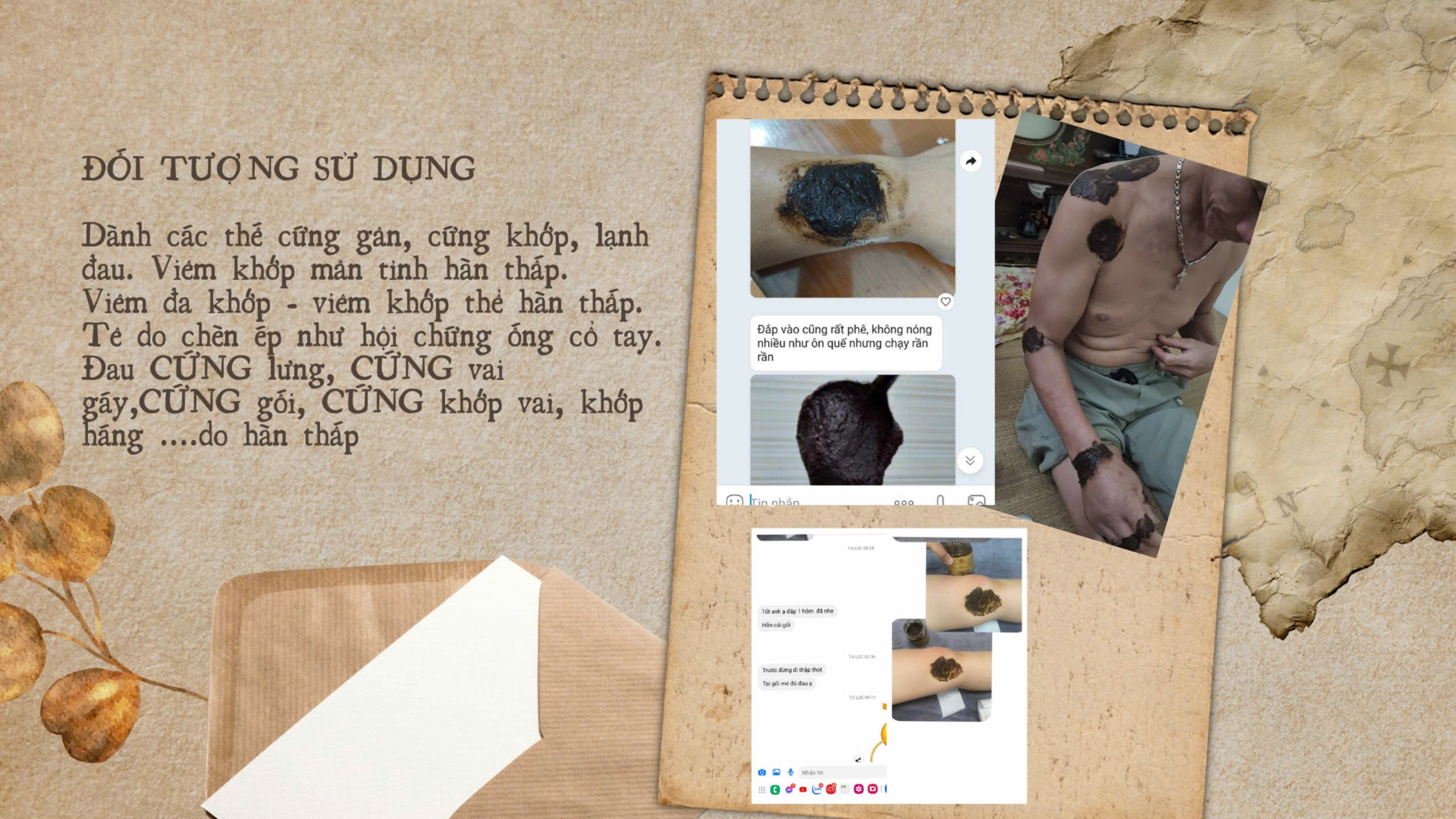 KIỆN GÂN DƯỠNG CỐT CAO