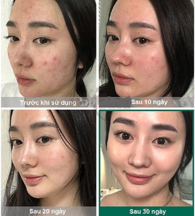 Kem Dưỡng Some By Mi AHA-BHA-PHA 30 Days Miracle Cream 60g