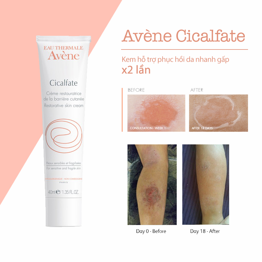 Kem dưỡng Avene Cicalfate Repair Giảm Thâm - Mờ Sẹo - Phục Hồi Da 40ml